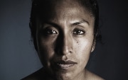 Gesicht einer gewaltbetroffenen Frau.